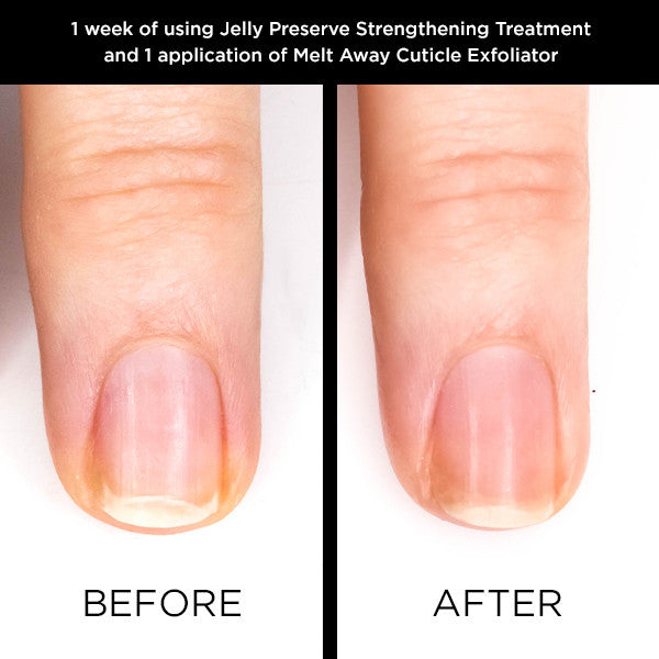 Strawberry Rhubarb Jelly Preserve Strengthening Treatment