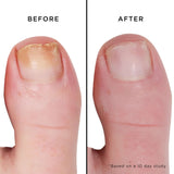 Mellow the Yellow Nail Brightening Treatment