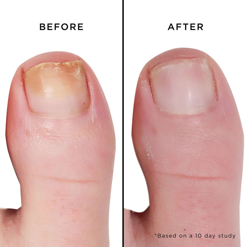 Mellow the Yellow Nail Brightening Treatment