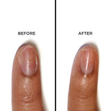 Strawberry Rhubarb Jelly Preserve Strengthening Treatment